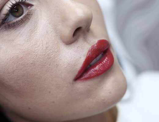 injectare acid mures