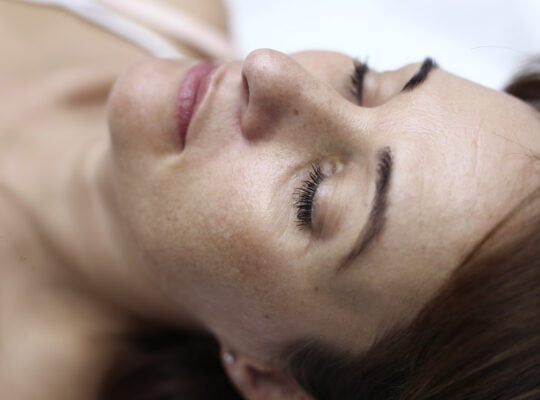 blefaroplastie mures