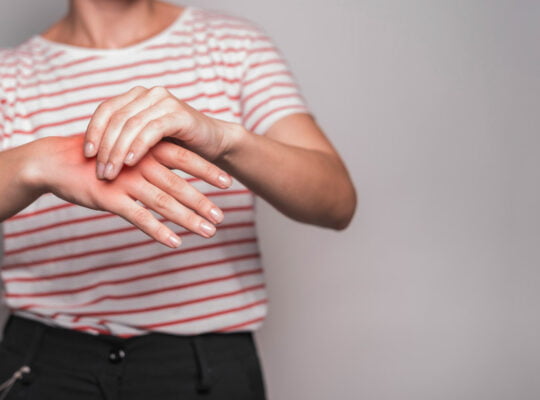 sindromul de tunel carpian